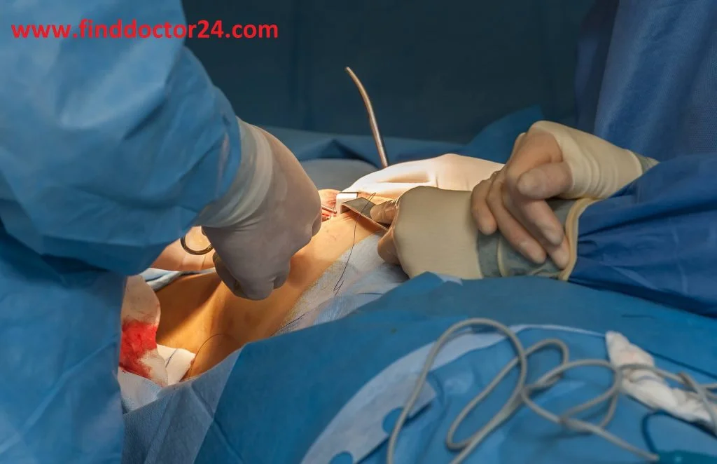 Breast Surgeon Doctor List