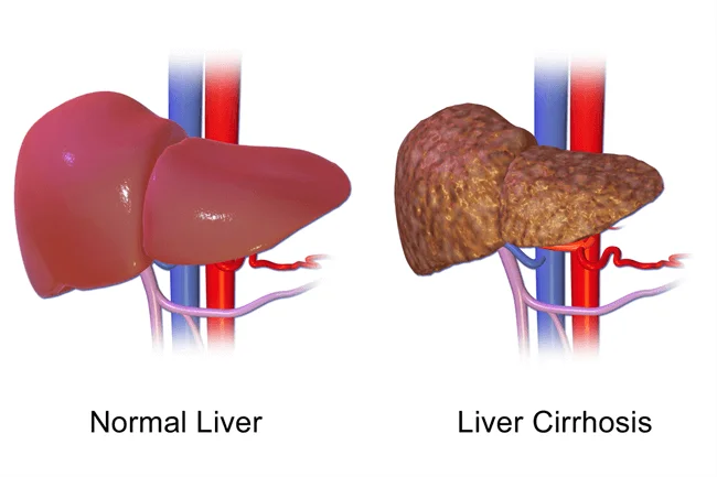 Liver Specialist Doctor