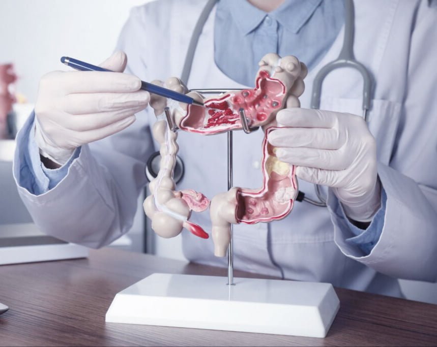 The Best Gastroenterologist in Rochester NY Find Doctor 24